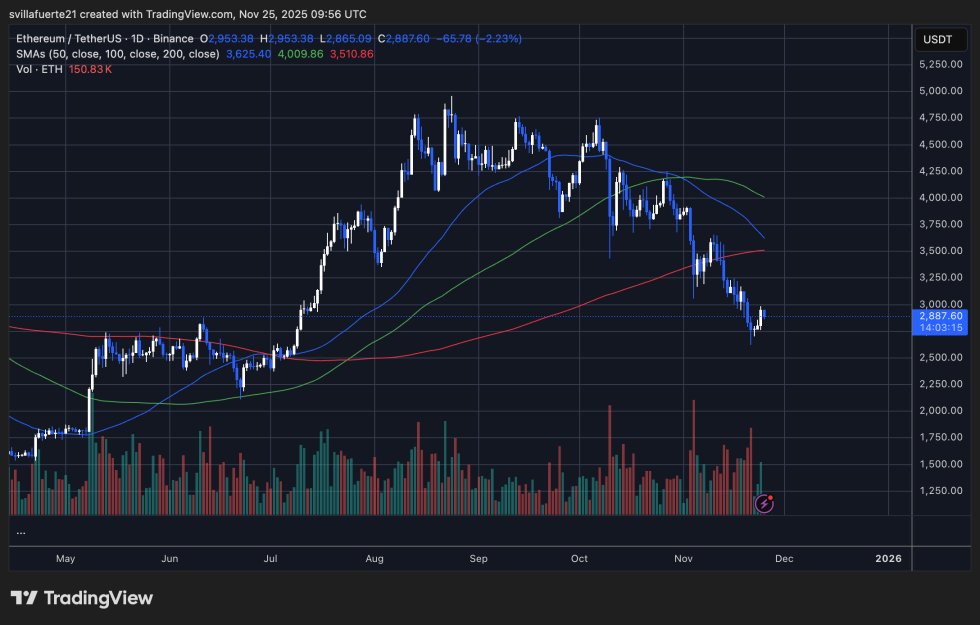 ETH kämpft darum, höhere Preise zurückzugewinnen | Quelle: ETHUSDT-Chart auf TradingView